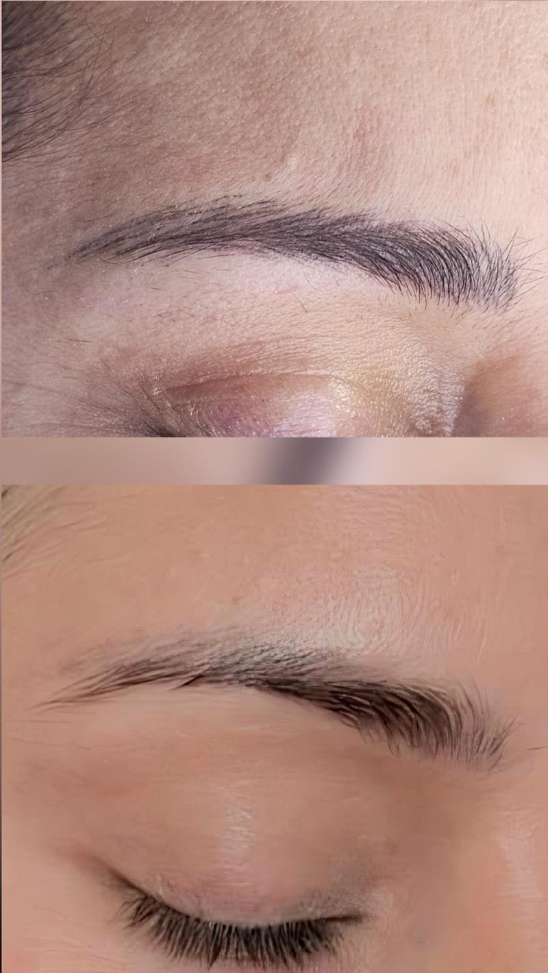 Before and after eyebrow pigment removal by Brenda Cazares, correcting a previous permanent makeup tattoo in National City.